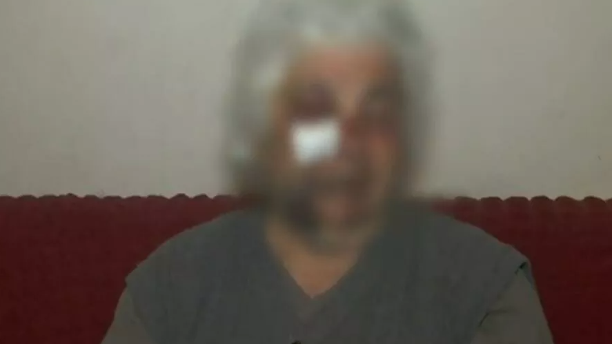 Φρίκη στο Αιγάλεω: Ληστές ξυλοκόπησαν 80χρονη